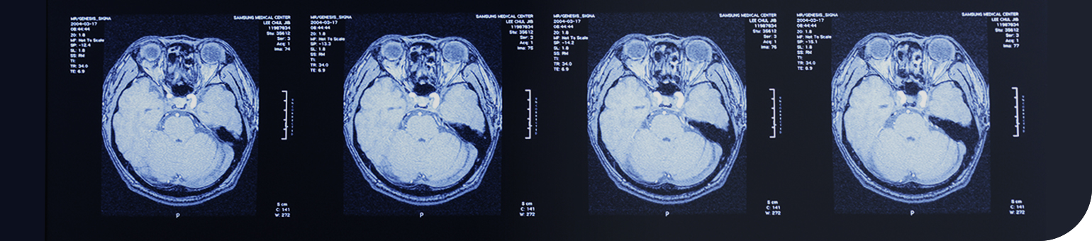 Gamma Knife Center