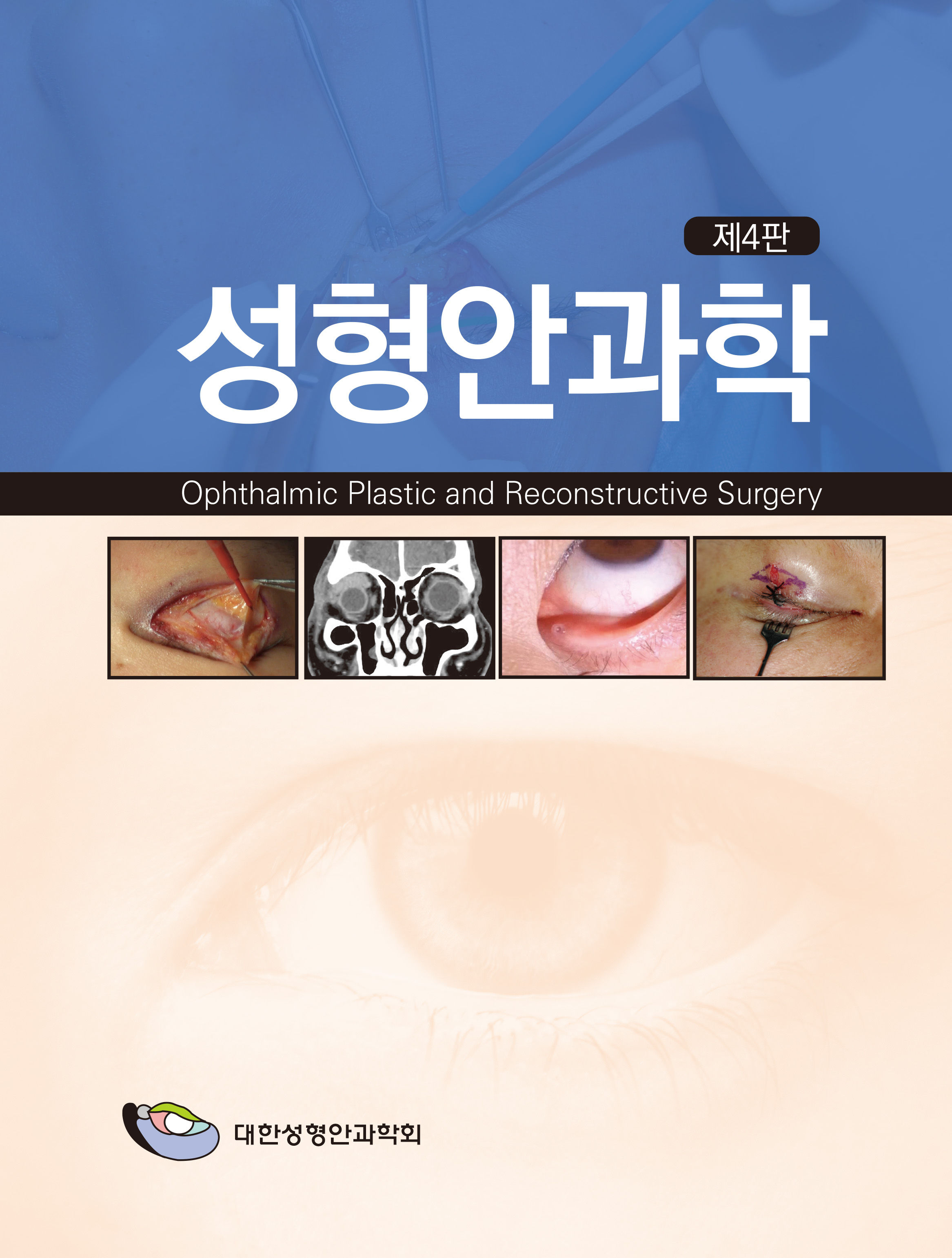 성형안과학 4판.jpg